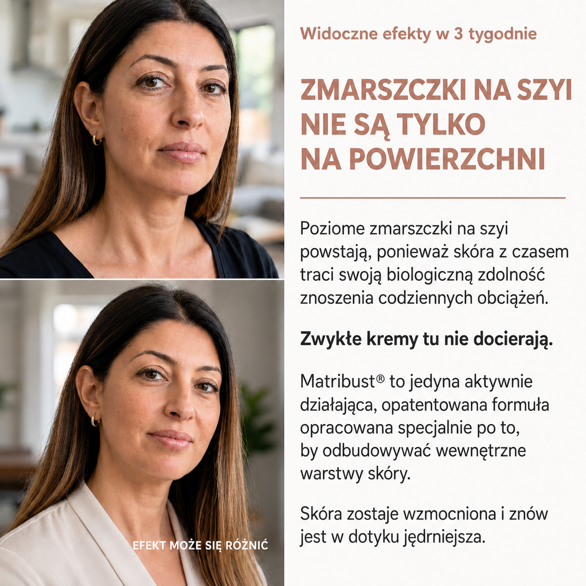 ALVEO - zmarszczki na szyi nie sa tylko na powierzchni